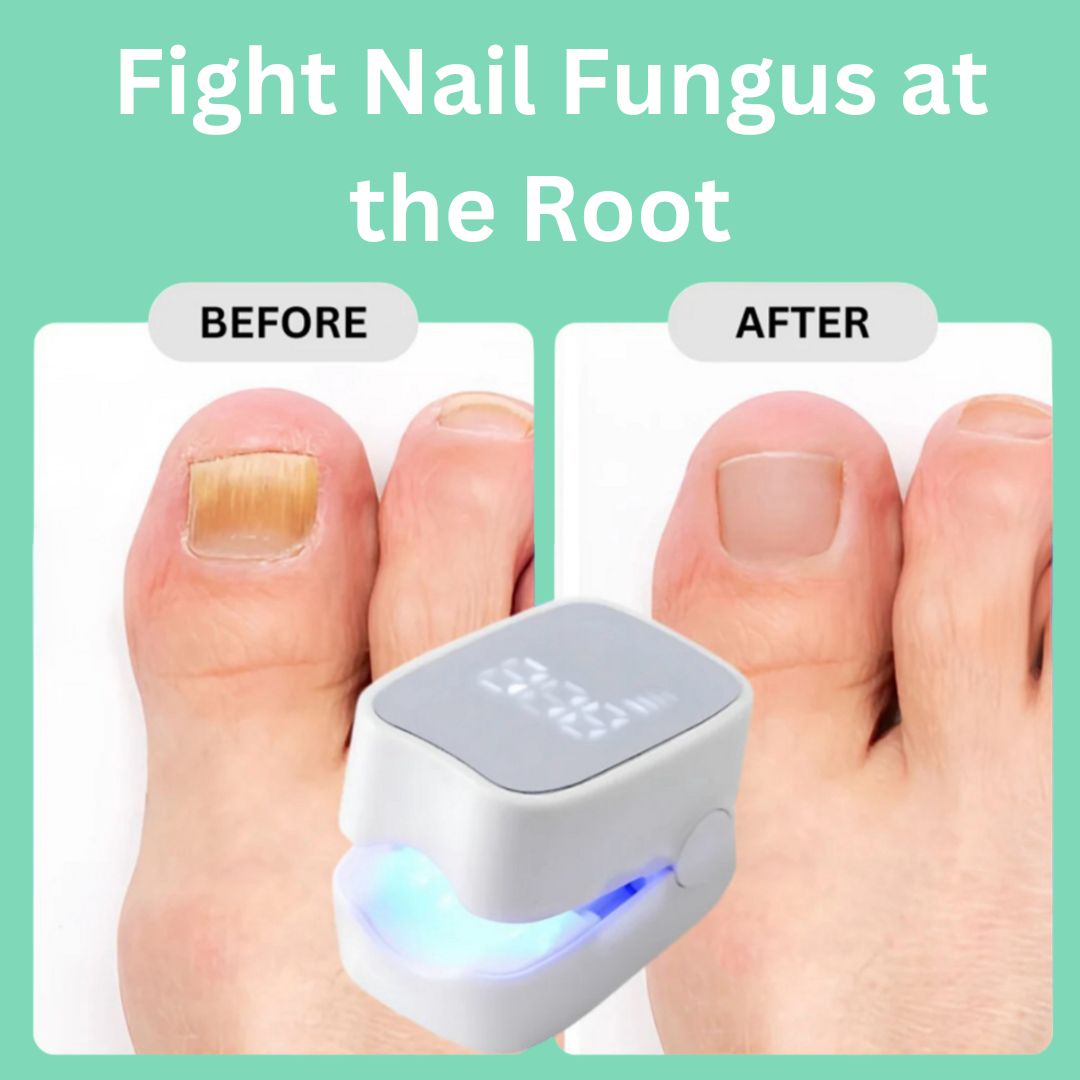 Briza Nail Laser