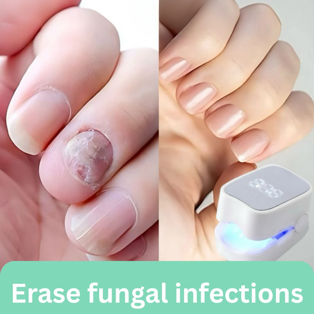 Briza Nail Laser