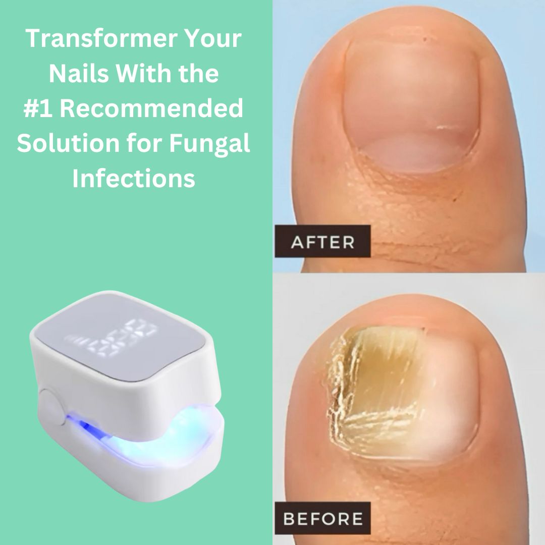 Briza Nail Laser