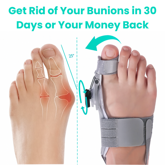 Briza Bunion stretcher