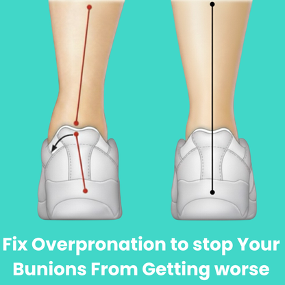 Briza Bunion Fix Bundle